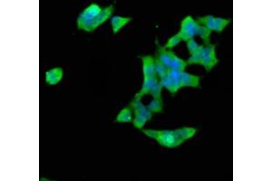 Immunofluorescence staining of 293 cells with ABIN7170440 at 1:66, counter-stained with DAPI. (SPTBN1 Antikörper  (AA 2096-2256))