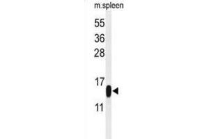 Western Blotting (WB) image for anti-Phospholipase A2, Group IB (PLA2G1B) antibody (ABIN3002154) (PLA2G1B Antikörper)