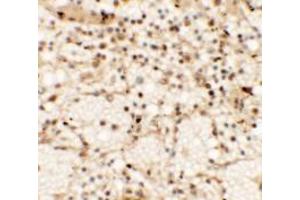 Immunohistochemistry of CLEC7A in human spleen tissue with CLEC7A antibody at 5 µg/ml. (CLEC7A Antikörper  (Middle Region))