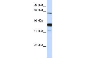 WB Suggested Anti-SMPD3 Antibody Titration:  0. (SMPD3 Antikörper  (Middle Region))