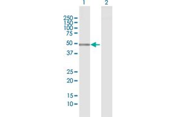 PTPN2 Antikörper  (AA 1-387)