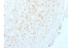 Formalin-fixed, paraffin-embedded human Tonsil stained with Aurora B Mouse Monoclonal Antibody (AURKB/1845).