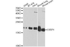 Western blot analysis of extracts of various cell lines, using CSRP1 Antibody. (CSRP1 Antikörper  (AA 1-193))