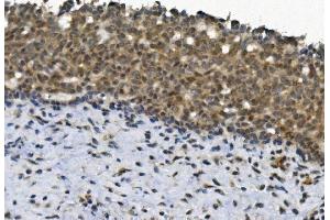 IHC analysis of EYA4 using anti-EYA4 antibody (ABIN7601063). (EYA4 Antikörper  (AA 28-205))