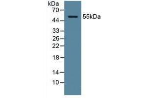 Detection of ODC in Human Serum using Polyclonal Antibody to Ornithine Decarboxylase (ODC) (ODC1 Antikörper  (AA 15-259))
