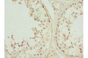 Immunohistochemistry of paraffin-embedded human testis tissue using ABIN7146876 at dilution of 1:100