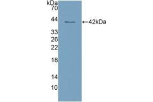 Western blot analysis of recombinant Human CLEC4L. (DC-SIGN/CD209 Antikörper  (AA 70-404))