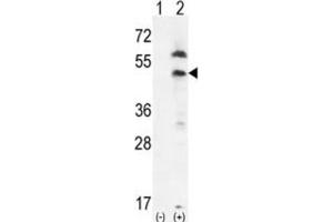 Western Blotting (WB) image for anti-Platelet-Derived Growth Factor Receptor-Like (PDGFRL) antibody (ABIN3003406) (PDGFRL Antikörper)