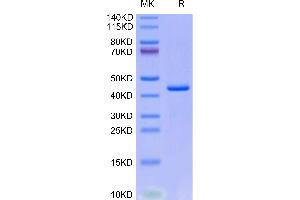 Human CXCL4L1 on Tris-Bis PAGE under reduced condition. (PF4V1 Protein (AA 31-104) (Fc Tag))