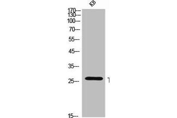 TNFSF8 Antikörper  (Internal Region)