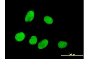 Immunofluorescence of purified MaxPab antibody to RPRD1A on HeLa cell. (RPRD1A Antikörper  (AA 1-289))
