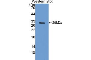 Western blot analysis of the recombinant protein. (IGFBP5 Antikörper  (AA 25-271))