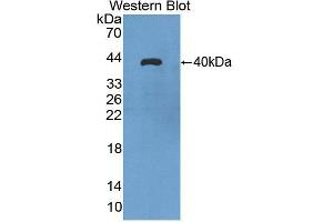 Western blot analysis of the recombinant protein. (Aquaporin 8 Antikörper  (AA 129-228))