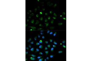 Immunofluorescence analysis of HeLa cell using PRF1 antibody. (Perforin 1 Antikörper  (AA 280-555))