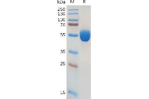 SDS-PAGE (SDS) image for Colony Stimulating Factor 2 (Granulocyte-Macrophage) (CSF2) (AA 18-144) protein (Fc Tag) (ABIN7092727)