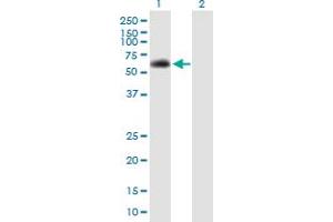 Western Blot analysis of SPAG8 expression in transfected 293T cell line by SPAG8 MaxPab polyclonal antibody. (SPAG8 Antikörper  (AA 1-501))