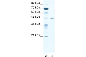 WB Suggested Anti-CTBP1 Antibody   Titration: 1. (CTBP1 Antikörper  (C-Term))