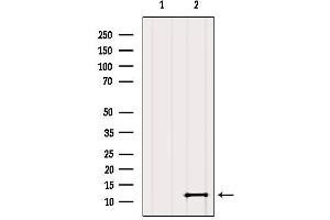 Western blot analysis of extracts from Mouse brain, using SH3BGRL2 Antibody. (SH3BGRL2 Antikörper  (Internal Region))