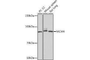 Western blot analysis of extracts of various cell lines, using MCM4 Rabbit mAb (ABIN7268545) at 1:1000 dilution. (MCM4 Antikörper)