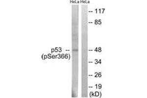 Western blot analysis of extracts from HeLa cells treated with Adriamycin 0. (p53 Antikörper  (pSer366))