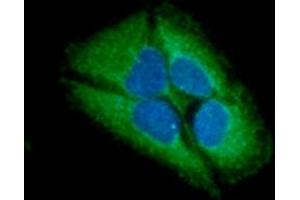 ICC/IF analysis of GARS in HeLa cells line, stained with DAPI (Blue) for nucleus staining and monoclonal anti-human GARS antibody (1:100) with goat anti-mouse IgG-Alexa fluor 488 conjugate (Green). (GARS Antikörper)