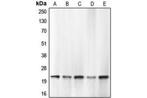Western blot analysis of Caspase 1 expression in HEK293T PMA-treated (A), THP1 (B), HL60 (C), mouse lung (D), rat lung (E) whole cell lysates. (Caspase 1 Antikörper  (Center))