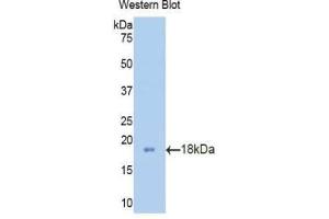 Western blot analysis of the recombinant protein. (PFN2 Antikörper  (AA 5-140))