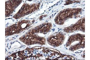 Immunohistochemical staining of paraffin-embedded Human Kidney tissue using anti-ENPEP mouse monoclonal antibody. (ENPEP Antikörper)