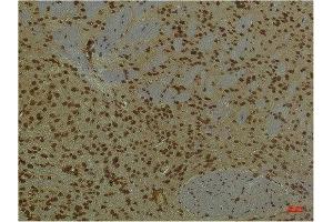 Immunohistochemical analysis of paraffin-embedded Mouse BrainTissue using HIF-1 β/ARNT Mouse mAb diluted at 1:200. (ARNT Antikörper)