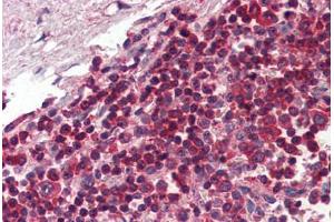 Human Spleen (formalin-fixed, paraffin-embedded) stained with TLR8 antibody ABIN334256 at 5 ug/ml followed by biotinylated anti-mouse IgG secondary antibody ABIN481714, alkaline phosphatase-streptavidin and chromogen. (TLR8 Antikörper  (AA 750-850))