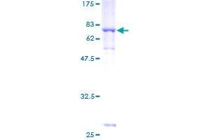 SDS-PAGE (SDS) image for Alpha Centractin (ACTR1A) (AA 1-376) protein (GST tag) (ABIN1305778) (ACTR1A Protein (AA 1-376) (GST tag))