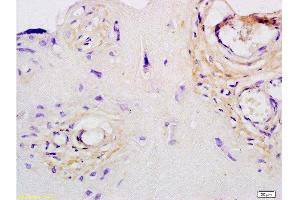 Formalin-fixed and paraffin embedded human placenta tissue labeled with Anti-Collagen III Polyclonal Antibody, Unconjugated  at 1:200, followed by conjugation to the secondary antibody and DAB staining (COL3 Antikörper  (AA 801-900))