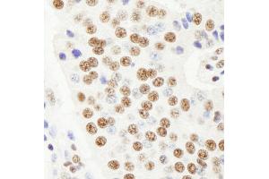 Immunohistochemistry (IHC) image for anti-Ras-Related GTP Binding A (RRAGA) (AA 544-594) antibody (ABIN7448966) (RRAGA Antikörper  (AA 544-594))