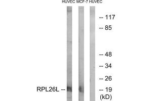 Western blot analysis of extracts from HUVEC cells and MCF-7 cells, using RPL26L antibody.