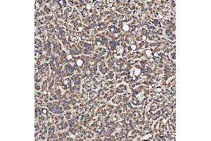 IHC analysis of SH2D4A using anti-SH2D4A antibody (ABIN7601695).