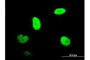 Immunofluorescence of monoclonal antibody to RNUT1 on HeLa cell. (Snurportin 1 Antikörper  (AA 1-360))