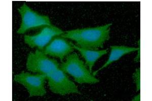 ICC/IF analysis of GSTT2 in HeLa cells line, stained with DAPI (Blue) for nucleus staining and monoclonal anti-human GSTT2 antibody (1:100) with goat anti-mouse IgG-Alexa fluor 488 conjugate (Green). (GSTT2 Antikörper  (AA 1-244))