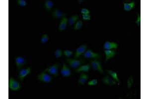 Immunofluorescence staining of Hela cells with ABIN7139916 at 1:50, counter-stained with DAPI. (LPAR5 Antikörper  (AA 310-326))