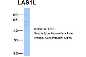 Host:  Rabbit  Target Name:  LAS1L  Sample Type:  Human Fetal Liver  Antibody Dilution:  1. (LAS1L Antikörper  (Middle Region))