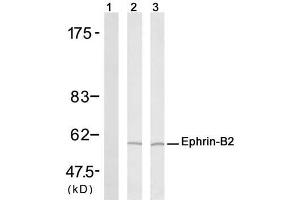 Western blot analysis of extract from H (Ephrin B2 Antikörper)