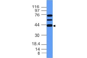 Image no. 1 for anti-Meis Homeobox 1 (MEIS1) (AA 163-352) antibody (ABIN5027352) (MEIS1 Antikörper  (AA 163-352))