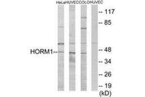 Western blot analysis of extracts from HeLa/HuvEc/COLO cells, using HORMAD1 Antibody.