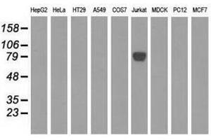 Image no. 3 for anti-EPM2A (Laforin) Interacting Protein 1 (EPM2AIP1) antibody (ABIN1498043) (EPM2AIP1 Antikörper)