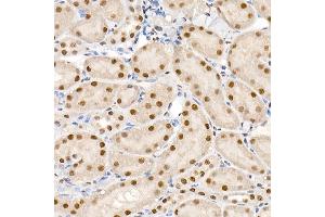 Immunohistochemistry of paraffin-embedded mouse kidney using Phospho-Smad2-S465/467 + Smad3-S423/425 Rabbit pAb (ABIN6135314, ABIN6136248, ABIN6136249 and ABIN6225575) at dilution of 1:50 (40x lens). (SMAD2 / SMAD3 (pSer423), (pSer425) Antikörper)