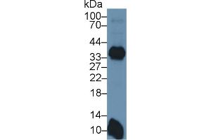 Western Blotting (WB) image for anti-Major Histocompatibility Complex, Class II, DR beta 1 (HLA-DRB1) (AA 27-264) antibody (ABIN7440767)