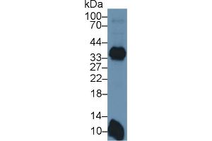 Detection of HLA-DRB1 in Mouse Spleen lysate using Polyclonal Antibody to HLA Class II Histocompatibility Antigen, DRB1 Beta Chain (HLA-DRB1) (HLA-DRB1 Antikörper  (AA 27-264))