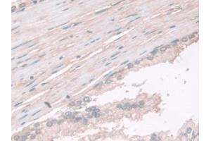 Immunohistochemistry (IHC) image for anti-Phosphoglucomutase 1 (PGM1) (AA 1-235) antibody (ABIN7444190)