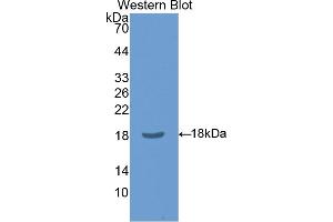 Western blot analysis of the recombinant protein. (CLIC4 Antikörper  (AA 104-253))