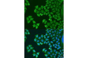 Immunofluorescence analysis of U2OS cells using SYT4 antibody (ABIN6129135, ABIN6148791, ABIN6148792 and ABIN6223676) at dilution of 1:100.