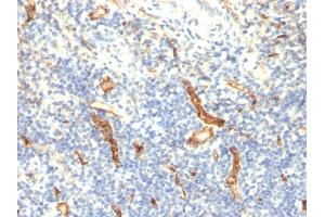 Formalin-fixed, paraffin-embedded human Tonsil stained with CD34 Monoclonal Antibody (HPCA1/1171) (CD34 Antikörper)